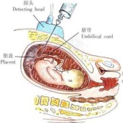 做脐带血穿刺会对胎儿有什么影响吗？会不会影响胎儿发育,胎儿脐带血穿刺多久出结果