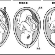 胎儿离宫颈口近的原因（胎儿离宫颈口近的原因）