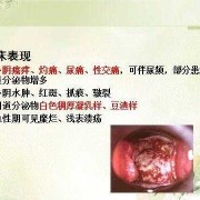 孕期阴道炎反反复复（阴道炎反复发作该如何治疗）