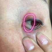 胎儿没眼球（宝宝白眼球里面有点发灰，是什么原因）