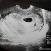 怀孕4个月女宝宝的特征,怀孕六个月女孩的特征
