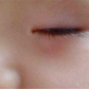九个月宝宝眼袋看起来好重,九个月胎儿图片