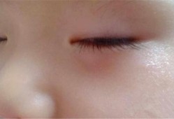 九个月宝宝眼袋看起来好重,九个月胎儿图片