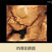 三维彩超结果怎么看,胎儿三维和四维有什么区别