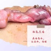 肛门息肉的症状有哪些,孕期息肉出血怎么办