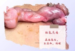 肛门息肉的症状有哪些,孕期息肉出血怎么办