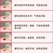 怀孕期间能拔罐吗（怀孕的时候还能够拔罐吗）