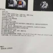 做四维显示左心室有强回声,胎儿左心房有强回声点