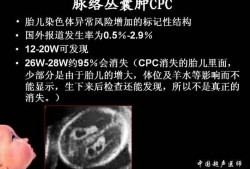 胎儿脉络从囊肿（胎儿脉络膜囊肿原因，脉络丛囊肿是怎么引起的）
