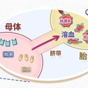 胎儿溶血怎么治疗（胎儿溶血怎么治疗方法）