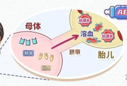胎儿溶血怎么治疗（胎儿溶血怎么治疗方法）