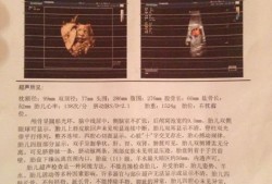 胎儿后颅窝池正常值（胎儿后颅窝池正常值）