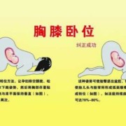 孕期胎儿体位（孕期胎儿体位不好）
