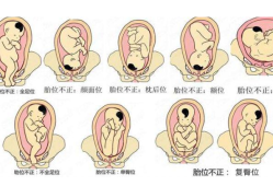 胎位正常胎儿在哪里动,胎儿胎位图解