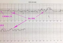胎心监护心率过高原因都有哪些了的啊,胎儿心跳高是怎么回事