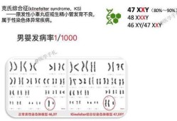 胎儿XXY（胎儿XXY染色体原因）