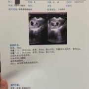 怀孕48天，孕酮17，hcg7万多，怎么办,孕期48天没有胎心胎芽