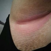 怀孕后腋窝有异味怎么办,孕期腋窝疼是怎么回事