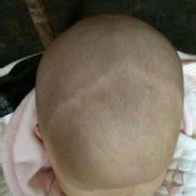 胎儿头有点大正常吗（刚出生的小宝宝头部比较长，能不能恢复）