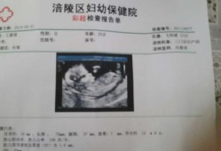 怀孕11周胎儿彩超图（怀孕11周胎儿彩超图片）