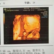 孕21周可以做四维吗,21周胎儿四维彩超图片