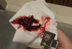 流产后胎儿的DNA在母体内会留存多久,胎儿的排泄物母体怎么排出去