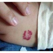 胎儿身上为啥有胎记（婴儿脸上有胎记是怎么回事）