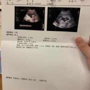 112天的宝宝应该多少斤,怀孕112天胎儿图片