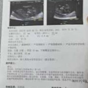 胎儿胃泡（怀孕19周做2维彩超说胎儿胃泡显示不清。怎么办）
