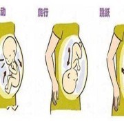 孕妇屁多怎么回事,孕期肠蠕动和胎动区别