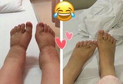 孕期脚变大能恢复吗（孕期脚变大会恢复吗）