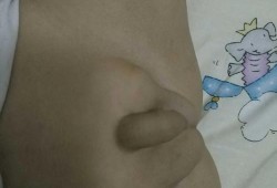 胎儿在鼓包（胎儿在鼓包是什么部位）