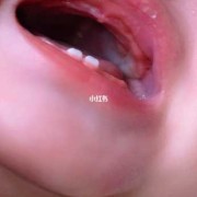 四个月宝宝长牙有什么症状,四个月胎儿样子图片