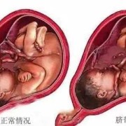 胎儿入盆后还会有胎动吗（胎儿入盆了还会脐带绕颈吗）