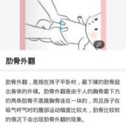 婴儿肋骨外翻怎么办,胎儿肋骨长标准