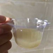孕期尿液混浊（小便混浊是怎么了）