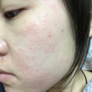 孕期皮肤变油（孕期皮肤变油是男是女）