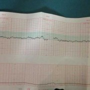 心率150正常吗,胎儿心跳150是男孩还是女孩?