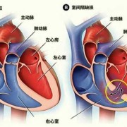 先天性心脏病的孕妈可以顺产吗,孕期心脏病有什么症状