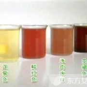 孕期尿黄正常吗（怀孕初期小便很黄怎么回事）