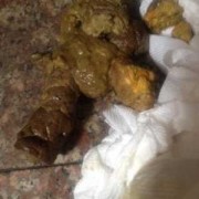 孕妇13周拉了好多屎,孕期拉的多正常么