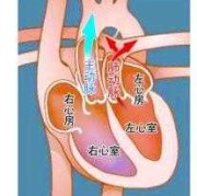 胎儿发育有的心脏为什么会发育不好,胎儿心脏大动脉转位能治好吗