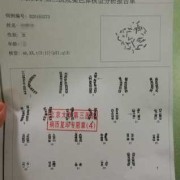 孕妇检查染色体过高有什么问题,胎儿染色体多一条是什么原因造成的