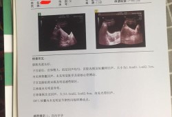 怀孕多少天可以见原始心管搏动,胎儿多久有心管搏动现象