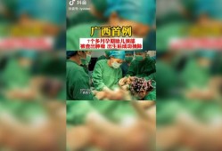 胎儿有瘤（产科医生婴儿肿瘤第几集）