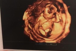 怀孕16周宝宝总在一侧动，正常吗,16周男胎儿特点图片