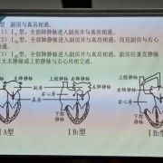 胎儿三心房（胎儿三心房）