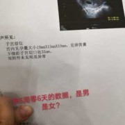 请问怀孕41天了，没有孕期反应，正常吗,孕期没反应说明什么