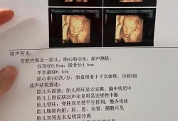 四维胎儿趴着怎么办（做四维彩超孩子趴着，看不到脸，怎么办）