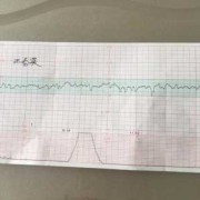 胎心监护一般多少周可以做,孕期胎心监护总不过关,为啥?